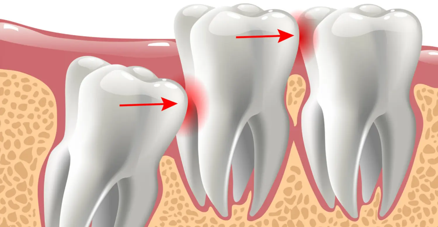 is orthodontic wax safe to swallow 2